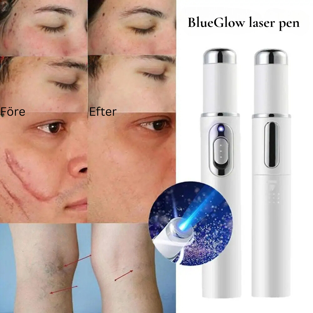 BlueGlow Laser Pen