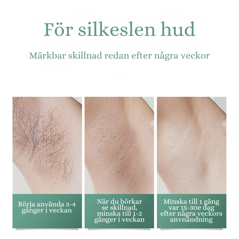 SilkSmooth - smärtfri laser för silkeslen hud